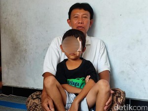 Bocah Ponorogo Sempat Dirujuk ke Jogja Usai Mata Luka Kena Benang Layangan