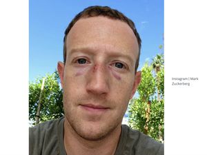 Mark Zuckerberg Pamer Wajah Bonyok: Pertarungan di Luar Kendali