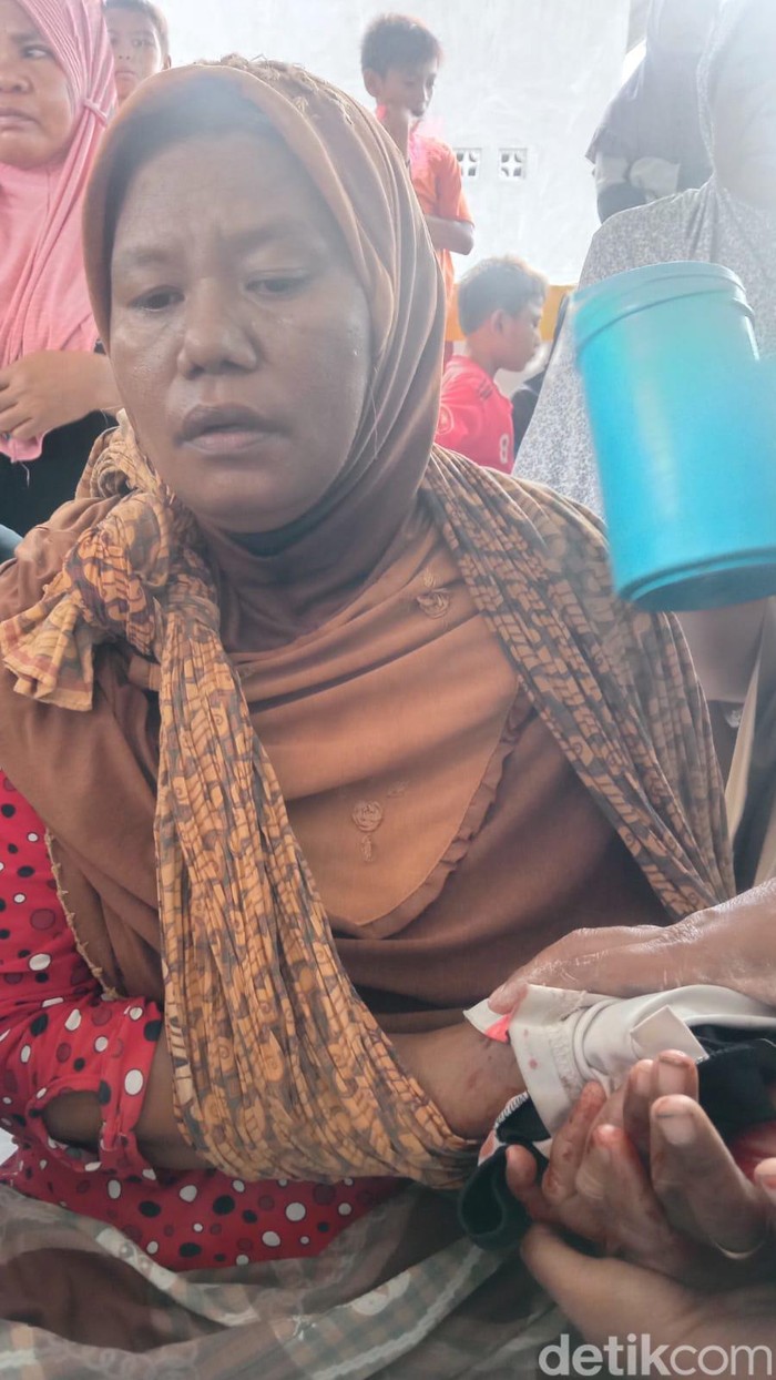 Seorang perempuan warga Pulau Rinca, TN Komodo, NTT, digigit komodo saat menjemur ikan di depan rumah.