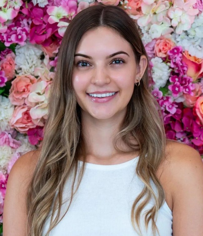 Natasha menjadi juara kontes kecantikan tanpa makeup pertama yang digelar di Britania Raya. Foto: Instagram/@natashaberesford