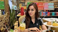 Safa Marwah mengaku pelipis berdarah akibat ditonjok pacar. (Foto: dok Instagram)
