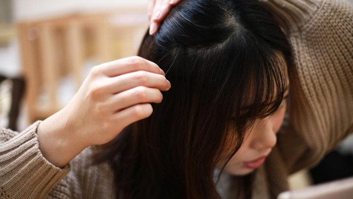 Kondisi Rambut Bisa Jadi Alarm Serius Kesehatan Seseorang, Waspadai Ciri-cirinya