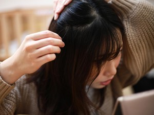 Kondisi Rambut Bisa Jadi Alarm Serius Kesehatan Seseorang, Waspadai Ciri-cirinya