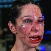 Kalah telak, Melanie Shah malah dianggap sebagai pemenang ketika bicara mengenai minat dan semangatnya dalam olahraga. Ini tidak berjalan sesuai yang aku inginkan tapi aku masih senang bisa sampai lima ronde. Bahkan jika aku tidak terlihat senang, aku menikmati semua proses. Aku menikmati ada di dalam ring dan menantang diriku sendiri,Jika aku bisa bertanding dengan Brit lagi, aku pikir yang akan aku lakukan adalah bertarung seperti aku mau bertarung. Aku tadi mundur sedikit dari yang seharusnya. Aku mungkin akan mencoba hal yang biasanya tidak aku kulakukan, ujarnya. Foto: Instagram @bareknucklenewstv