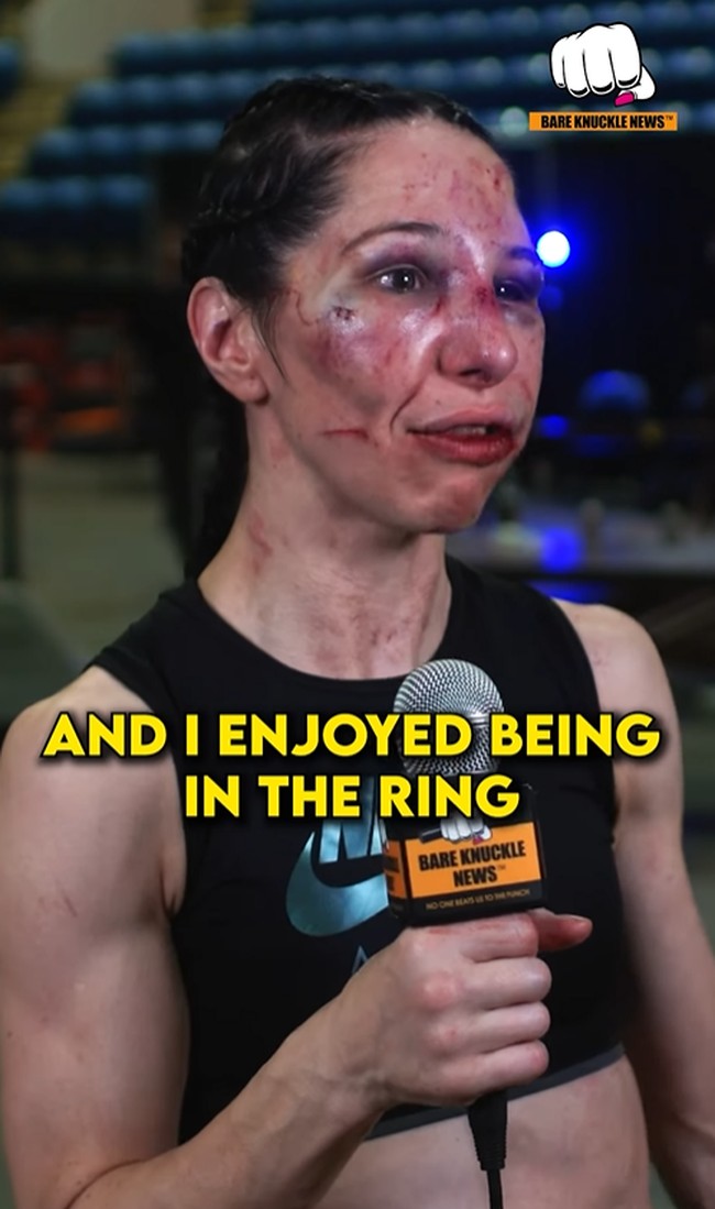 Wawancara dilakukan selagi wajahnya terluka, lebam, dan bengkak. Bagian mulutnya juga terlihat membalon. Karenanya, banyak orang salut dengan kegigihan Melanie.Aku pikir setelah ronde pertama, aku sadar bahwa dia jauh lebih kuat dari yang aku bayangkan. Walaupun aku sudah berekspektasi dia akan tangguh, aku berharap dia menunjukkan sedikit kelelahan, katanya.Foto: Instagram @bareknucklenewstv