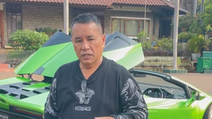 Curhat Hotman Paris Jalani Pemasangan Ring Jantung, Habis Rp 500 Juta