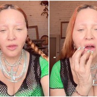 Terlihat kulitnya yang kencang, namun kaku yang biasanya hasil dari botox. Pipi dan bibir yang terlihat bengkak pun diduga efek filler. “Dia salah dokter yang memberikan filler di salah tempat,” kritik netizen. “Ya tuhan apa yang terjadi dengannya,” komentar netizen lainnya.Foto: dok. Instagram