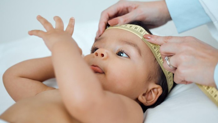 Viral Curhat Kepala Bayi Peyang Setelah Lahir, Ortu Harus Apa Jika Mengalami?