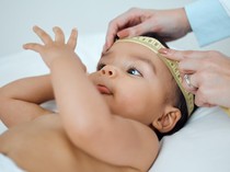 Viral Curhat Kepala Bayi Peyang Setelah Lahir, Ortu Harus Apa Jika Mengalami?