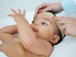 Viral Curhat Kepala Bayi Peyang Setelah Lahir, Ortu Harus Apa Jika Mengalami?