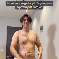 Tak hanya Awkarin, rupanya sang kekasih, Jonathan Alden juga ikut menjajal prosedur kecantikan tersebut. Tampak Jonathan yang melakukan konsultasi terlebih dahulu sebelum operasi dilakukan. Foto: Instagram/@narinkovilda