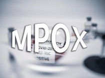 Kemenkes Temukan 14 Kasus Mpox di Tahun 2024