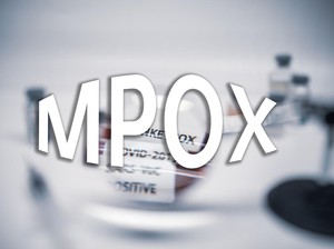 Dinkes DKI Laporkan Kasus Suspek Baru, 2 Anak Diduga Terkena Mpox