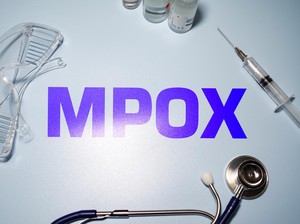 1 Pasien Cacar Monyet Mpox yang Meninggal Sempat Alami Masalah Pencernaan