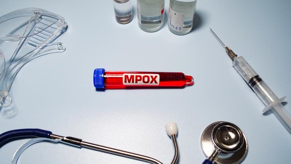 Kasus Cacar Mpox di RI Kini Tembus 30 Kasus 