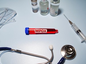 Strain Baru Cacar Monyet Mpox Ditemukan di Inggris, Gabungan Dua Tipe Virus