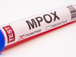 Fakta-fakta Kematian Pasien Mpox Cacar Monyet di Indonesia