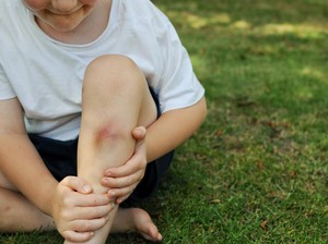 Studi Harvard Ungkap Cara agar Luka Lebih Cepat Sembuh Lewat Manipulasi Waktu