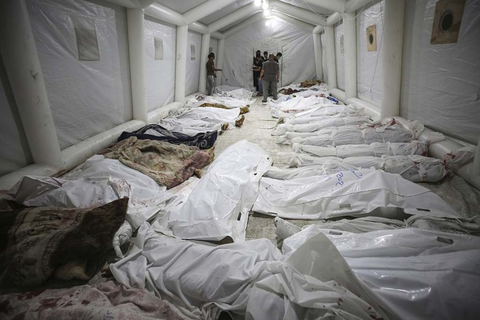 Wounded Palestinians Ahli Arab hospital at the al-Shifa hospital, following Israeli airstrikes, in Gaza City, central Gaza Strip, Tuesday, Oct. 17, 2023. (AP Photo/Abed Khaled)
