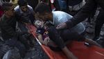 Potret Evakuasi Anak-anak di Gaza yang Terluka Akibat Serangan Israel