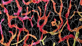 Juara keempat belas diraih John-Oliver Dum. Menampilkan gambar Serbuk sari bunga matahari pada jarum akupunktur Foto: Nikon Small World Photomicrography