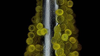 Foto: Nikon Small World Photomicrography