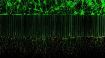 Juara kesepuluh diraih Melinda Beccari & Dr. Don W. Cleveland. Menampilkan gambar Neuron motorik tumbuh dalam perangkat mikrofluida untuk pemisahan badan sel (atas) dan akson (bawah). Hijau – mikrotubulus; Merah – kerucut pertumbuhan (aktin)  Foto: Nikon Small World Photomicrography