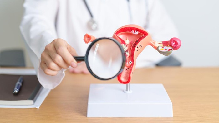 Wanita Mengeluh Perut Kembung Dikira Sakit Lambung, Ternyata Kanker Stadium 4