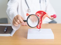 Wanita Mengeluh Perut Kembung Dikira Sakit Lambung, Ternyata Kanker Stadium 4