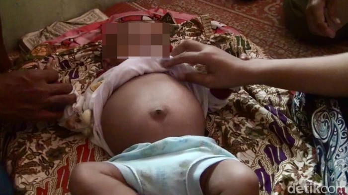 Adnan, bayi yang disebut orang tuanya hamil 4 bulan. (Jeka Kampai/detikSumut)