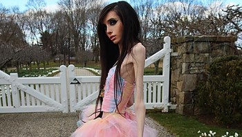 Namun, Cooney juga menjadi sosok kontroversial karena penampilannya yang sangat kurus, yang membuat banyak orang khawatir bahwa dia menderita gangguan makan, kemungkinan anoreksia nervosa. Foto: Instagram.com/eugeniacooney