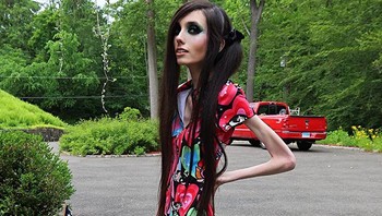 Cooney sendiri tidak pernah secara terbuka mengakui bahwa dia memiliki gangguan makan, meskipun dia mengatakan bahwa dia memiliki masalah kesehatan yang tidak ingin dia umumkan. Foto: Instagram.com/eugeniacooney