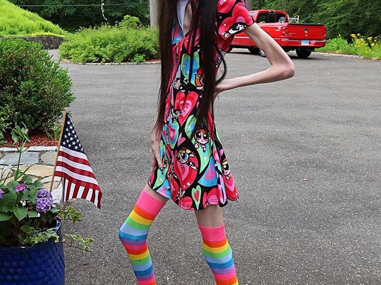 Penampilan Eugenia Cooney, YouTuber Bertubuh Sangat Kurus