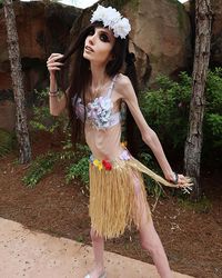 Penampilan Eugenia Cooney, YouTuber Bertubuh Sangat Kurus