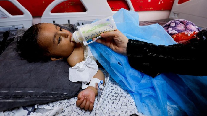 ISRAEL-PALESTINIANS/GAZA-TWINS Wateen, a 14 months old Palestinian who was injured in an Israeli strike which killed her mother and injured her twin brother Ahmed, rests at Nasser hospital, in Khan Younis, in the southern Gaza Strip, October 23, 2023. REUTERS/Mohammed Salem