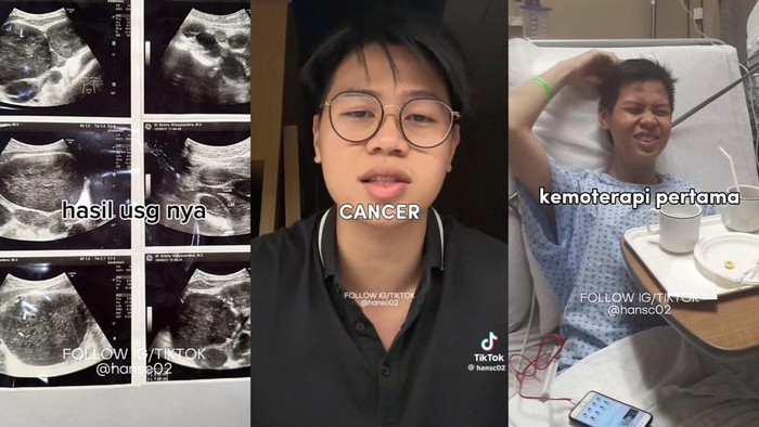 Viral Pria Bandung Berjuang Lawan Kanker Limfoma, Keluhkan Sering Beser