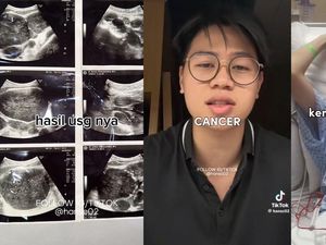 Kondisi Terkini Pria Bandung yang Idap Kanker Limfoma, 6 Kali Kemo-Dinyatakan Remisi