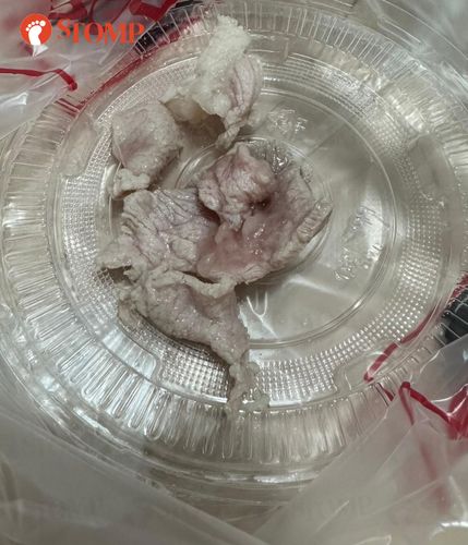 Termakan Daging Babi Mentah Wanita Ini Muntah Sampai Fobia Daging Babi
