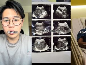 Viral Pria Umur 21 Kena Kanker Getah Bening, Gejala Awalnya Gampang Capek