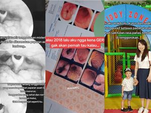 Kisah Wanita Surabaya Idap GERD, Alami Gejala Sakit Tenggorokan Tak Kunjung Sembuh