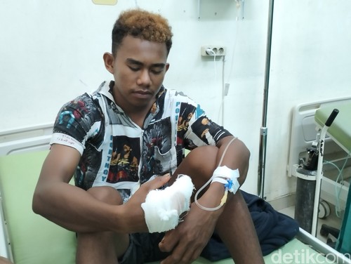 Muhaimin, warga Pulau Rinca yang digigit komodo menjalani perawatan di UGD RSUD Komodo Labuan Bajo. (Ambrosius Ardin)