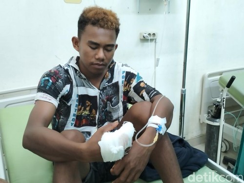 Muhaimin, warga Pulau Rinca yang digigit komodo menjalani perawatan di UGD RSUD Komodo Labuan Bajo. (Ambrosius Ardin)