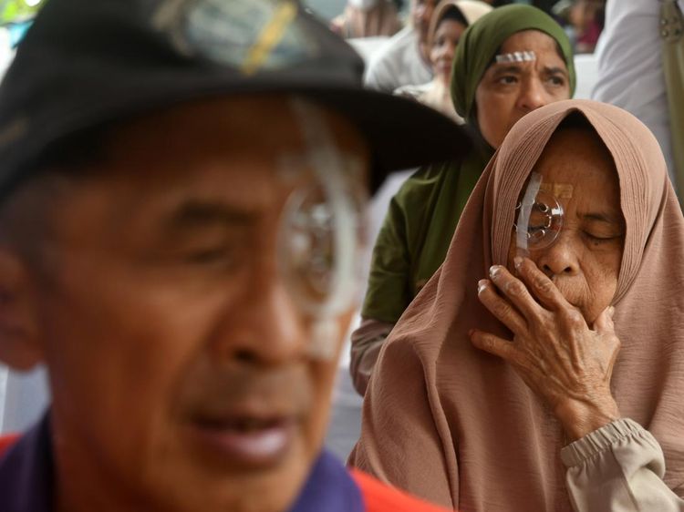 Operasi Katarak Gratis untuk Warga Bogor