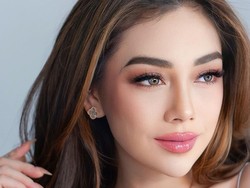 7 Potret Terbaru Celine Evangelista yang Makin Cantik Dengan Bibir Tebal