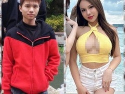 Transformasi Viral Youtuber yang Operasi Plastik di Thailand: Bak Beda Orang