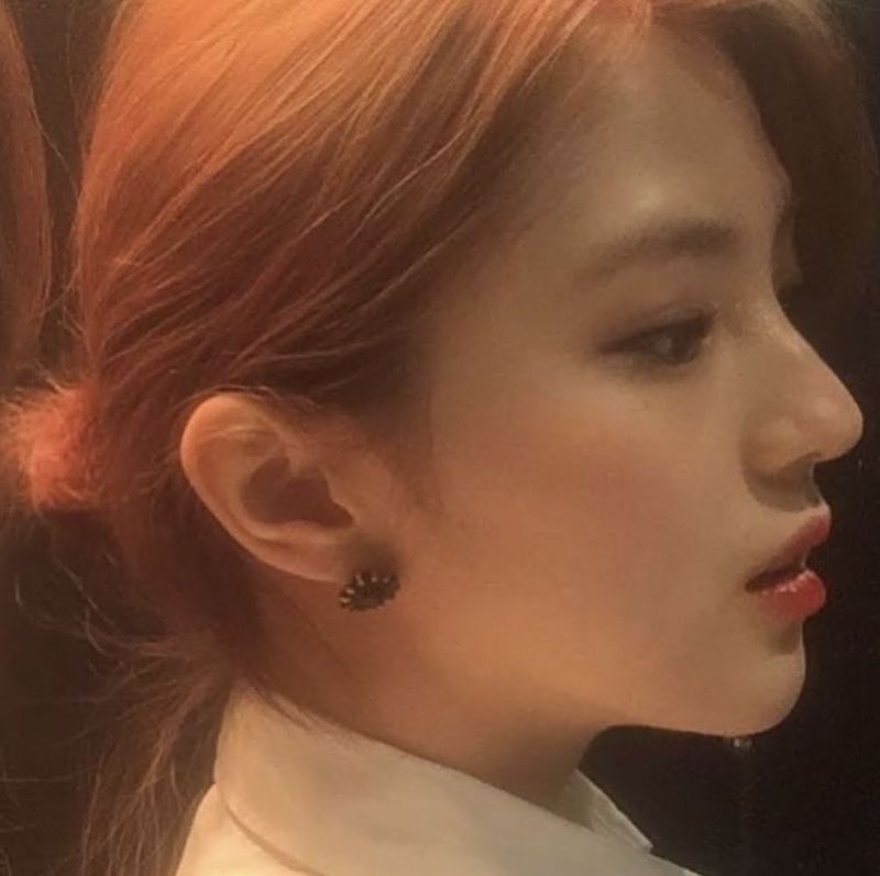 Han So Hee Jalani Operasi Hidung Tiba-tiba, Alasannya Tak Terduga