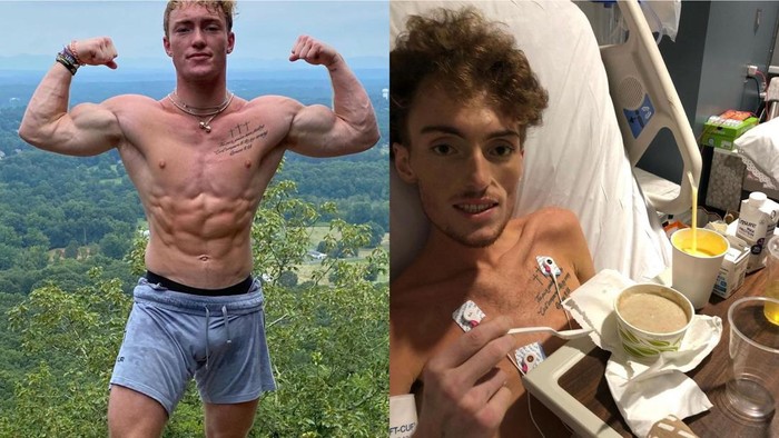 Awal Mula Influencer Kebugaran Kena Kanker Limfoma, Sering Berkeringat Malam Hari