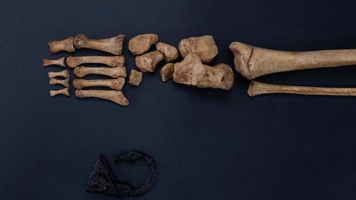 Arkeolog Ungkap Rahasia Pemakaman 'Vampir' di Polandia Professor Dariusz Polinski, the lead archaeologist from Nicolaus Copernicus University, poses with the remains of a woman found at the 17th century cemetery for rejected people in the village of Pien,  in Torun, Poland, October 27, 2023. The woman's body was found with a padlock on her leg and a sickle around the neck which suggest the person was believed to be a 'vampire' and was secured to the ground to avoid 'her rising from the grave'. REUTERS/Lukasz Glowala