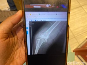 Amarah Ortu Bocah Korban Bully Sukabumi