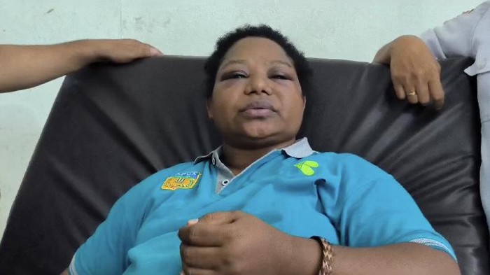 Petugas kesehatan bernama Angganita Mandowen yang dianiaya di Kabupaten Yahukimo.